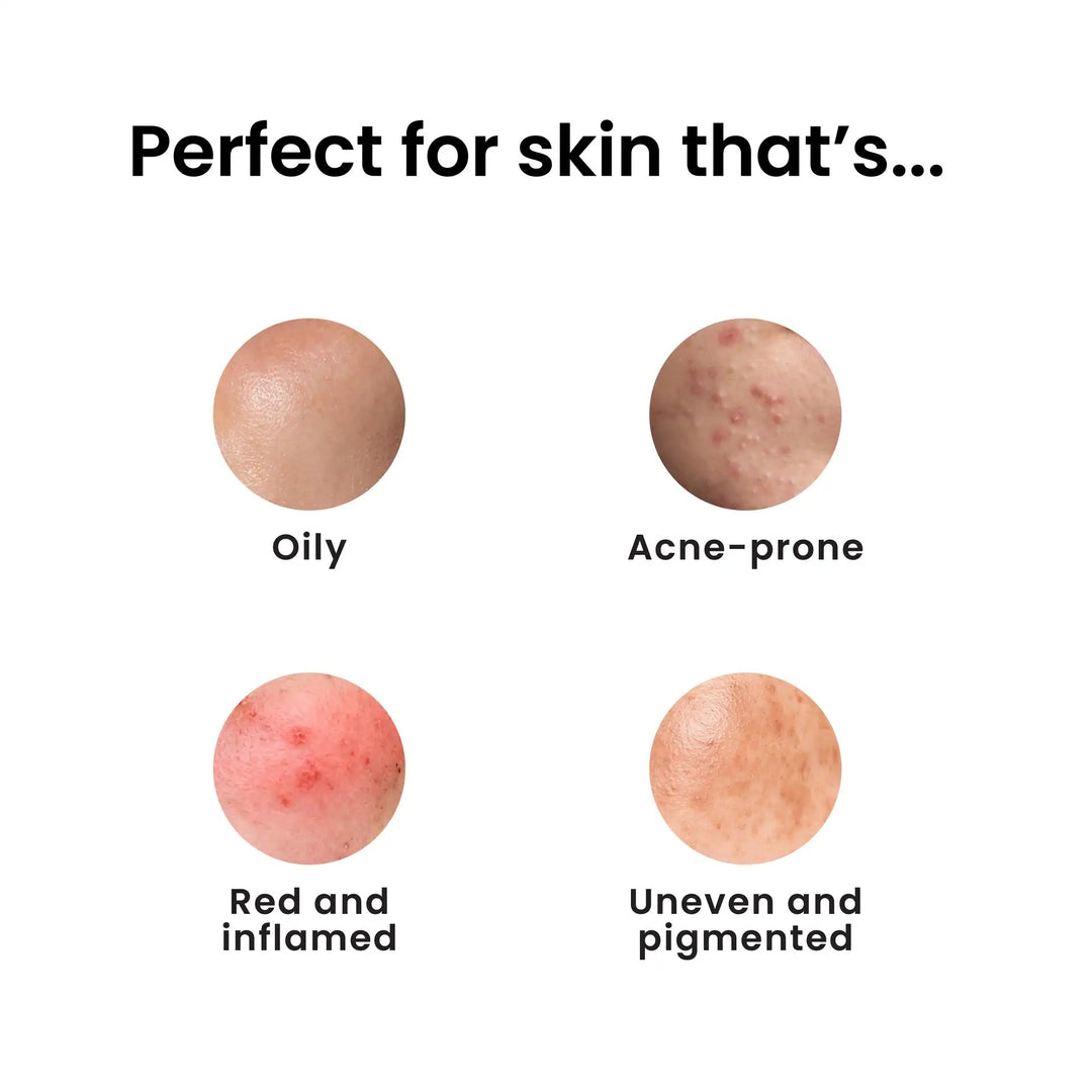 EVEN GLOW  FACE CREAM